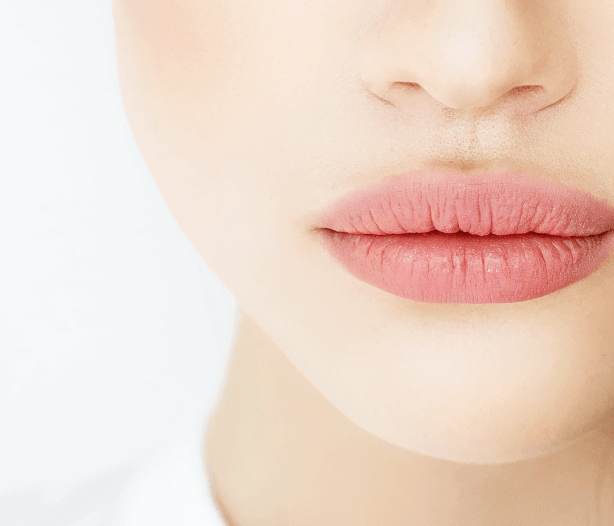 Lip Lift